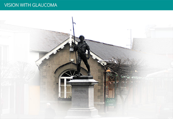 Vision with Glaucoma Ryans Opticians and Medical Eye Center Wexford